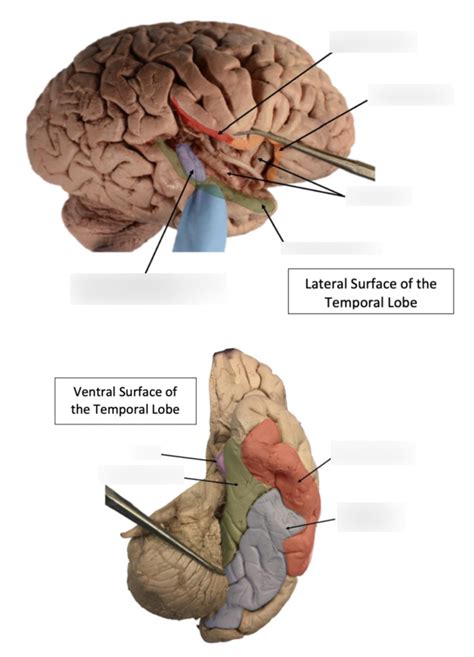 Neuro Lab 7: Temporal Lobe Diagram | Quizlet