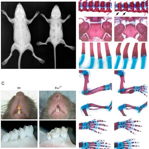 Phenotype Of Evc Mice A Radiographs At P B Skeletal