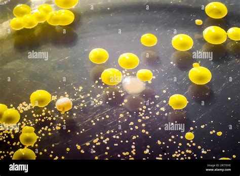 Bacteria Grown From A Skin Smear Colonies Of Micrococcus Luteus And