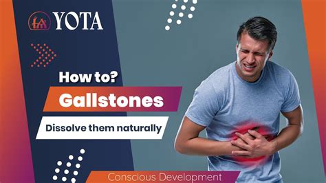 💥 Dissolve Gallstones Naturally Steps To Crush Soft And Calcified Stones Yota School Youtube