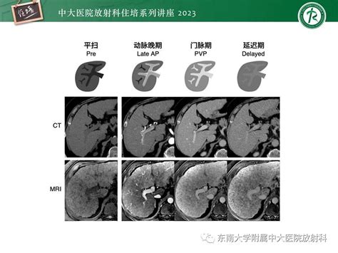 【ppt】 肝脏影像通用术语和图谱解读 影像ppt