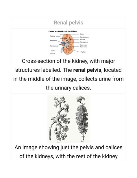 SOLUTION: Renal pelvis - Studypool