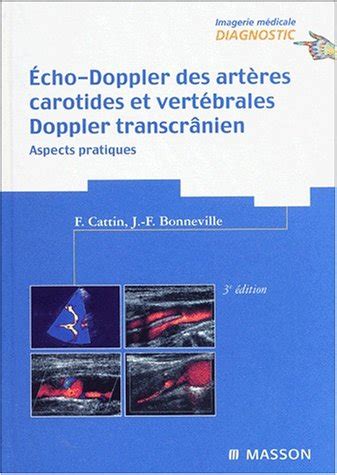 Echo doppler des artères carotides vertébrales Doppler transcrânien