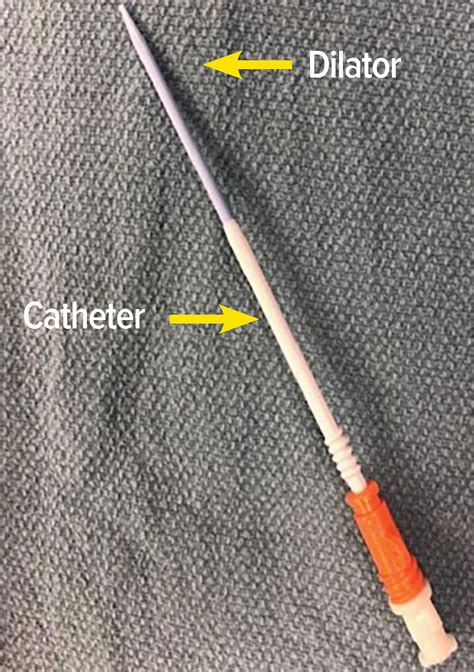 Rapid Infusion Catheter Flow Rate