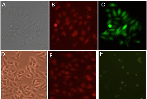 Expression Of GFP In Transfected Hepatoma Cells SMMC 7721 Cells Were