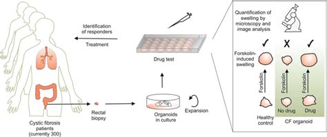 Measurement Of CFTR Function With Organoids Cystic Fibrosis CF Is