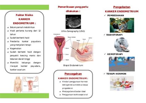 Leaflet Kanker Endometrium