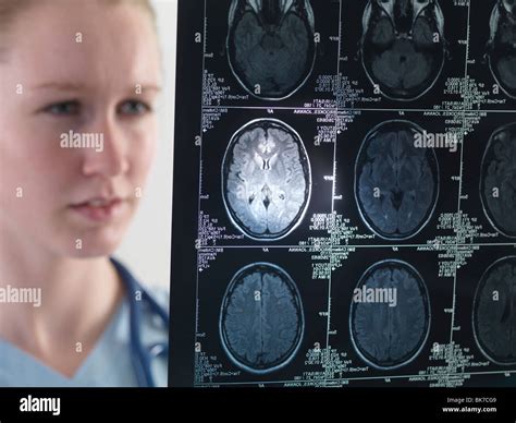 Doctor Studying An MRI Scan Stock Photo Alamy