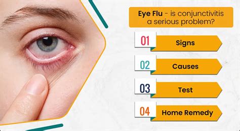 Why Conjunctivitis Pink Eye Occur? Tests & Symptoms