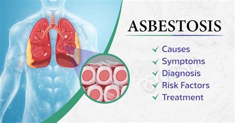 Asbestosis Causes Symptoms Diagnosis Risk Factors And Treatment