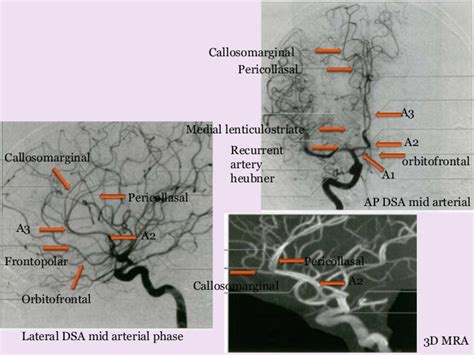 Arterial And Venous Supply Of Brain Part2