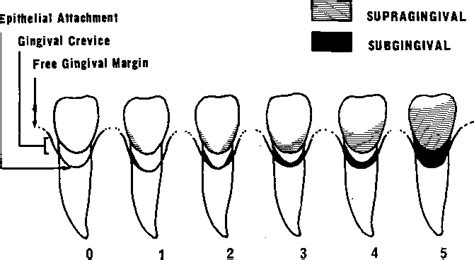 Figure 1 From Pilot Investigation Of Correlations Between Supragingival