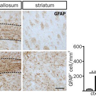 Activated Phagocytic Phenotype Of Iba Cells In Mbp H Syn Mice