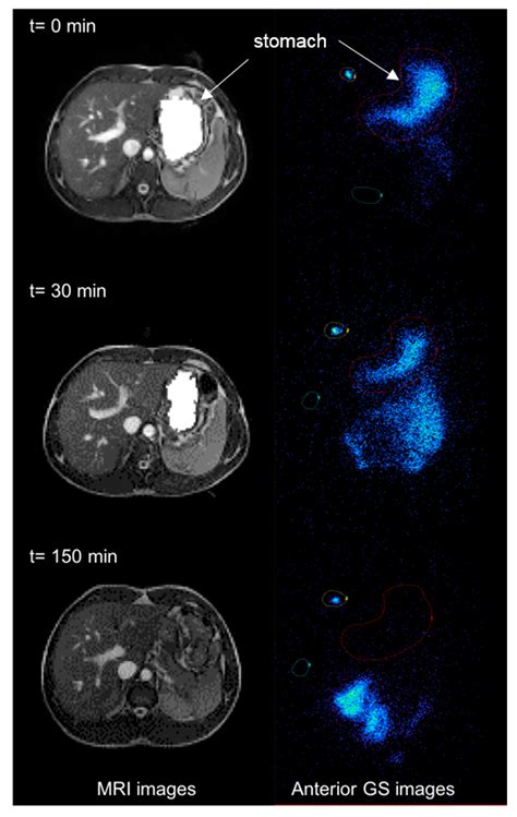 Diagnostics Free Full Text Simultaneous Measurement Of Gastric