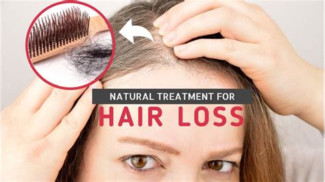 Natural Treatment For Hair Loss Youtube