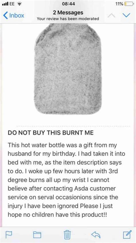 ASDA Customer Posts Gruesome Images Of Burns She Claims Were Caused By Faulty Hot Water Bottle