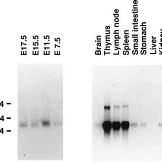 Northern Blot Analysis Of Pb Ckr Mrna Expression Poly A Rna From