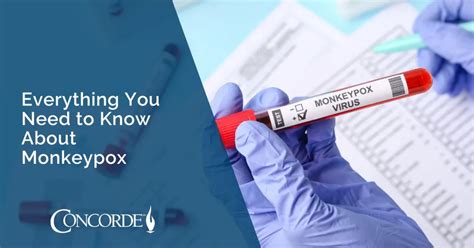Everything You Need To Know About Monkeypox | Concorde Career Colleges