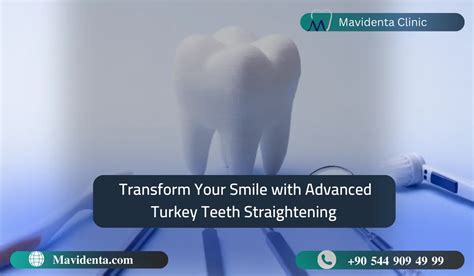 Transform Ur Smile With Advanced Turkey Teeth Straightening