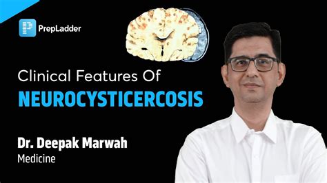 Clinical Features Of Neurocysticercosis By Dr Deepak Marwah Youtube