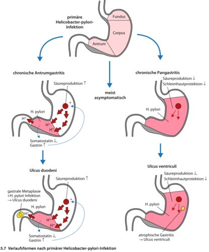 Verdauungssystem Pathologie Flashcards Quizlet