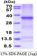 Human Dcr Tnfrsf B Elisa Kit Price Picokine Bosterbio