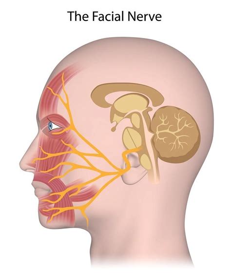 Porażenie neuralgia nerwu trójdzielnego objawy leczenie przyczyny