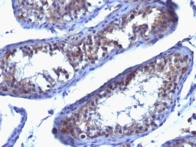 Prolactin Receptor Prl R Spm Bsa And Azide Free Abcam