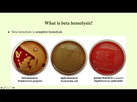 Beta Hemolytical Streptococci Beta Hemolysis On Blood Agar