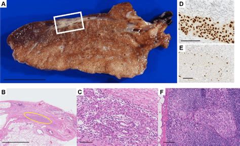 Histological Examination Of Surgical Specimens A Gross Findings Of