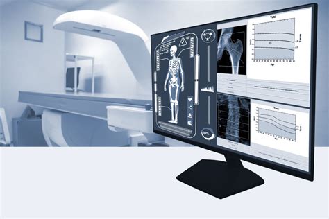 ¿qué Es Y Cuánto Cuesta Una Densitometría ósea Resobert Medicina And Radiología