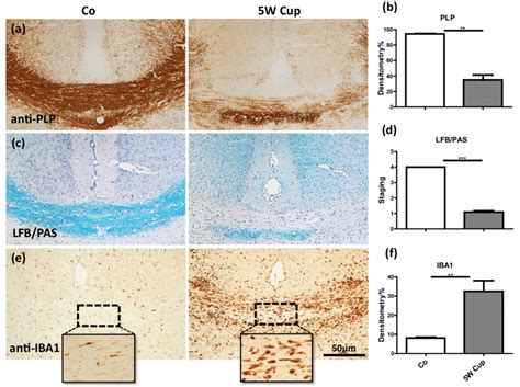 Immunohistochemical Analysis Of Demyelination And Microgliamacrophage