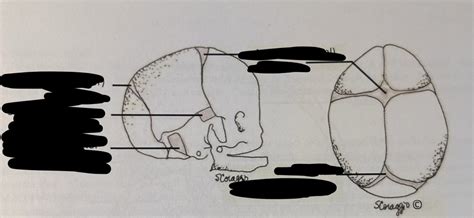 Fetal Skull Lateral And Superior Views Diagram Quizlet