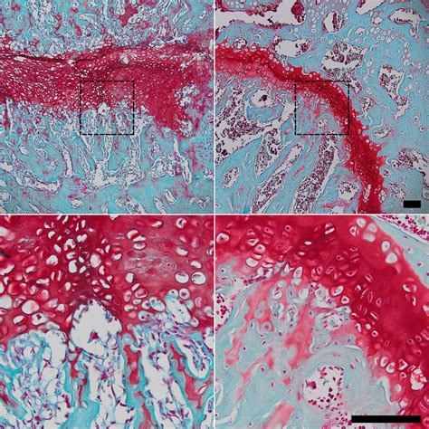 Using The Force To Augment Bone Regeneration Eurekalert