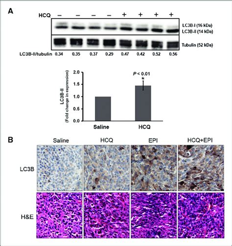 Assessment Of In Vivo Autophagy Related Protein Levels In Mda Mb