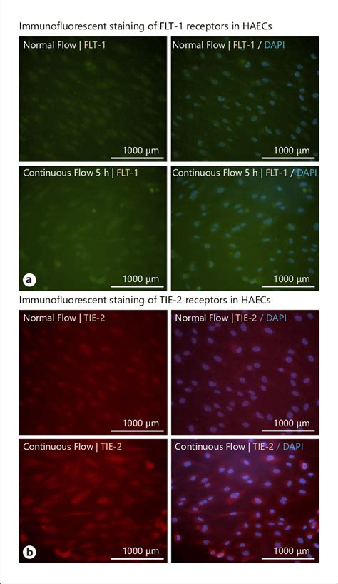 A Immunofluorescence Staining Of FLT 1 And B TIE 2 Surface Receptors In