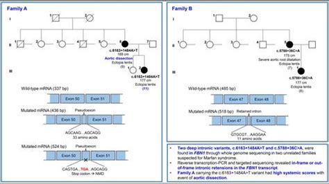 Overcoming Challenges Associated With Identifying Fbn1 Deep Intronic Variants Through Whole