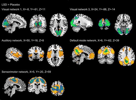 Acute effects of lysergic acid diethylamide (LSD) on resting brain function
