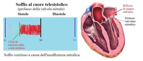 Soffio Al Cuore Sintomi Nei Bambini Neonati E In Gravidanza Cause