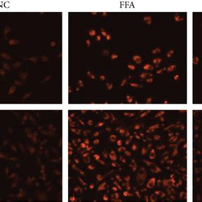 4 OI Alleviates FFA Induced Lipid Accumulation In Hepatocytes The