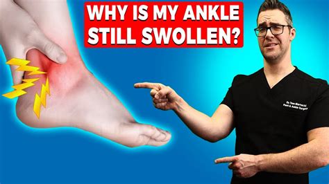 Sprained Ankle Pain Getting Worse 3 6 12 Mo How To Treat