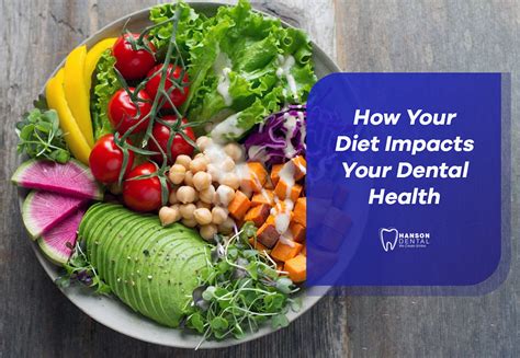 How Your Diet Impacts Your Dental Health Hanson Dental Dentist In Buffalo Mn