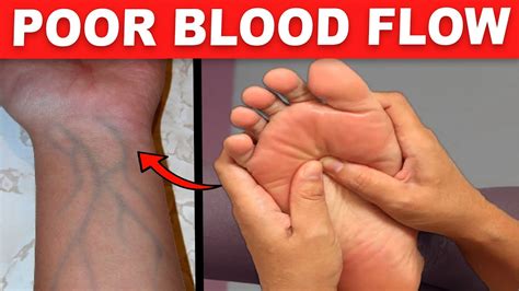 Common Signs You Have Poor Blood Circulation Without Even Knowing It