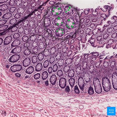 Histologie Differentialdiagnose Magen Darm Trakt Kenhub