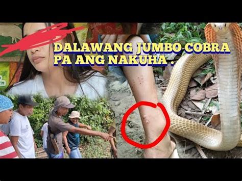 PART 2 UPDATE SA DALAGA NA NAKAGAT NG COBRA HULE ANG DALAWANG JUMBO