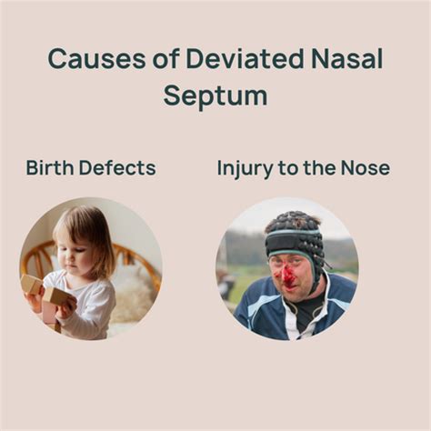 Deviated Nasal Septum: Causes, Symptoms and Treatment – Bibo