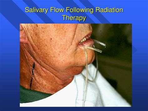 PPT Introduction To The Salivary Glands PowerPoint Presentation Free