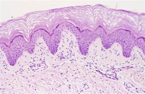 Aphy Ch The Integumentary System Lab Ivy Tech Flashcards Quizlet