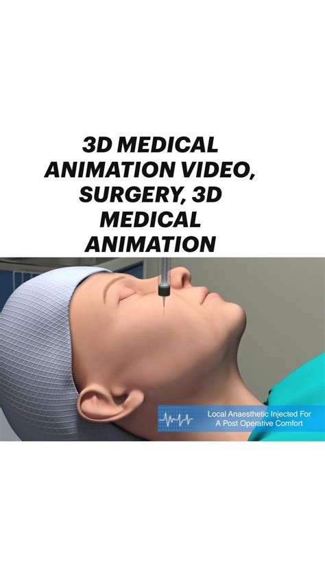 medical animation video surgery  medical animation medical