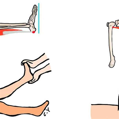 A Unilateral Popliteal Angle The Participant Is In The Supine